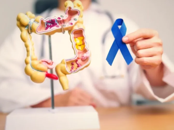 Pași pentru pregătirea înainte de intervenție chirurgicală colorectală