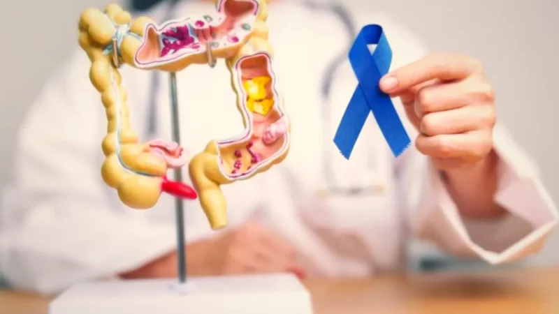 Pași pentru pregătirea înainte de intervenție chirurgicală colorectală
