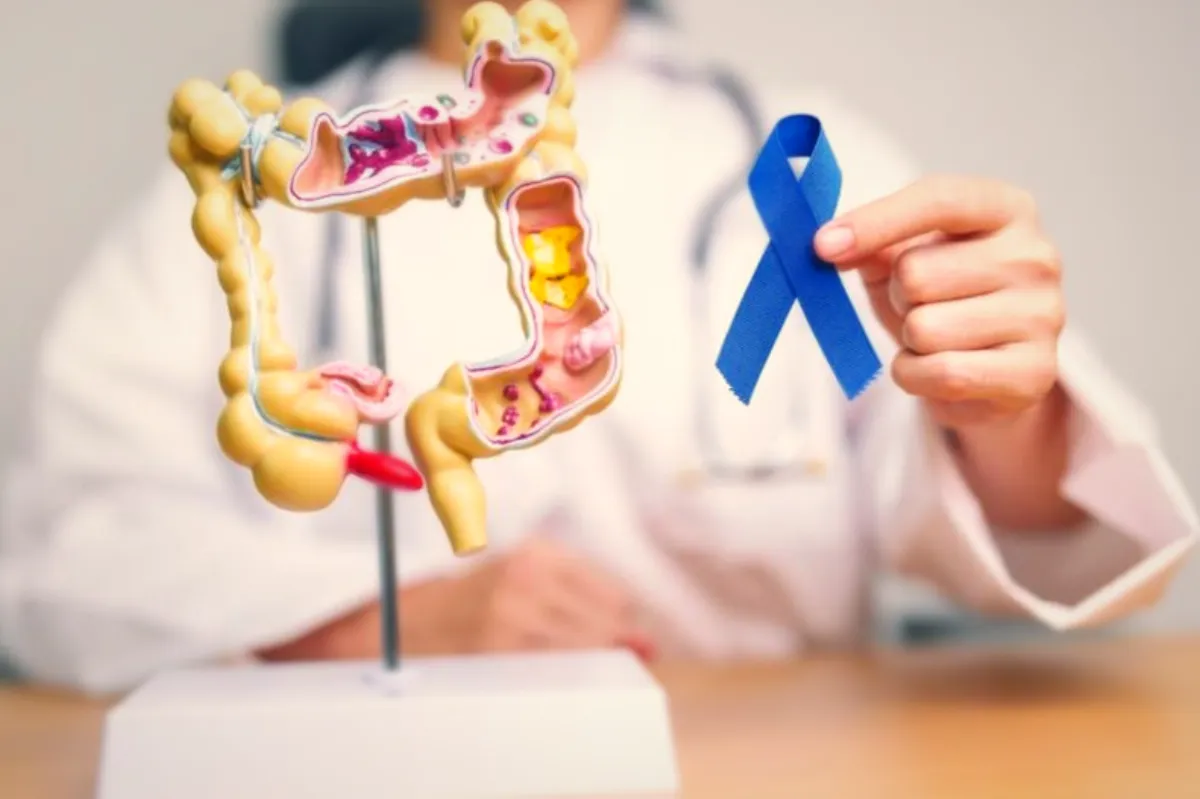 Pași pentru pregătirea înainte de intervenție chirurgicală colorectală